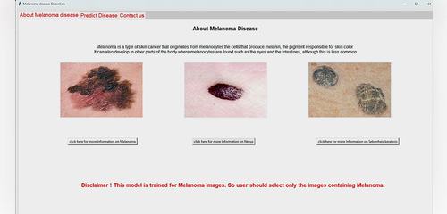 melanoma detection